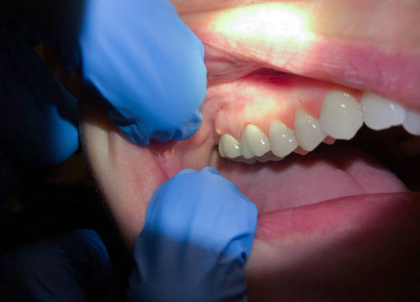 Best After-Hours Dental Trauma Care in Conley, GA