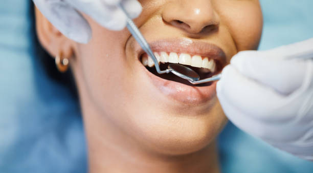 Best Emergency Dental Care for Broken or Chipped Teeth in Conley, GA