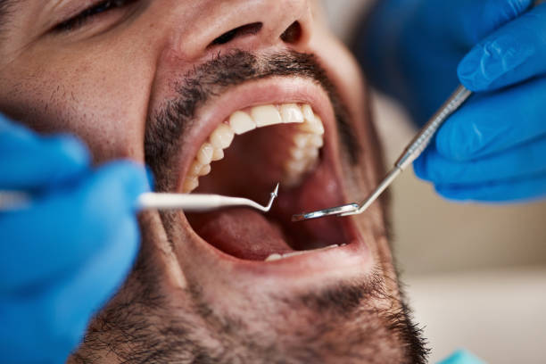 Best Emergency Tooth Extraction in Conley, GA