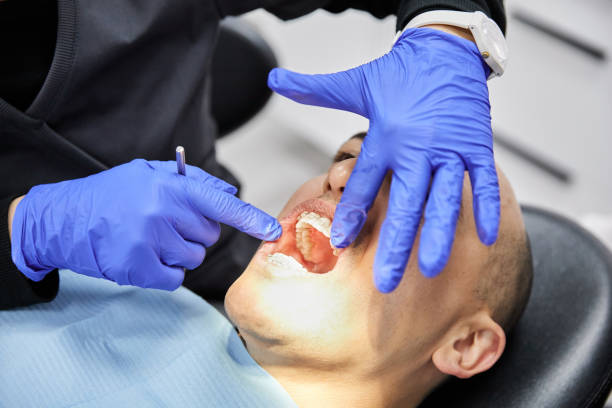 Best Emergency Treatment for Dental Infections or Abscesses in Conley, GA